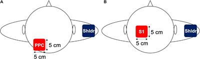 Region-Specific Effects of 10-Hz Transcranial Alternate Current Stimulation Over the Left Posterior Parietal Cortex and Primary Somatosensory Area on Tactile Two-Point Discrimination Threshold